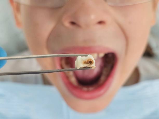 Best Urgent Dental Care in Black Forest, CO