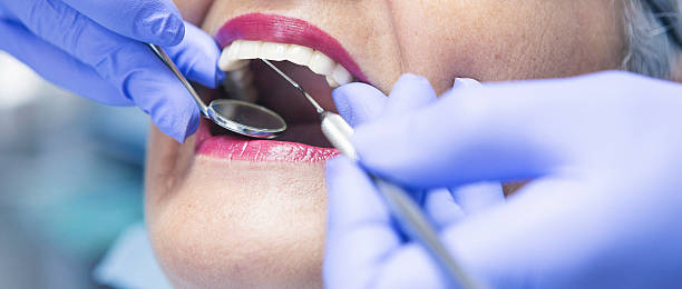 Best Emergency Wisdom Teeth Removal in Black Forest, CO